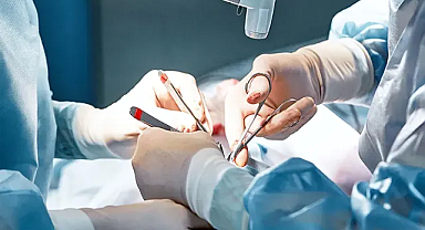 Dünyada En Çok Estetik Operasyon Yapılan Ülkeler Hangileri?