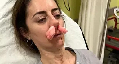 Kendisini eşinin sevgilisi zanneden kadın tarafından darbedildi