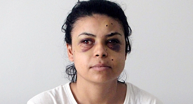 Düğünde tüfekle ateş açıldı, penceredeki Nazar gözlerinden yaralandı