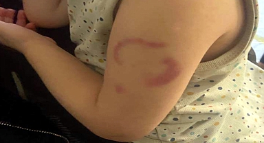 Bakımevinde 3 yaşındaki öğrencisinin kolunu ısıran öğretmen tutuklandı